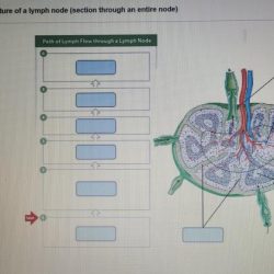 Lymphatic system drainage massage diagram lymphedema manual lymph lipedema vessels function nodes body upper detox flow google via only main